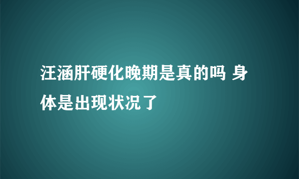 汪涵肝硬化晚期是真的吗 身体是出现状况了