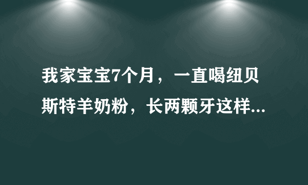 我家宝宝7个月，一直喝纽贝斯特羊奶粉，长两颗牙这样正常吗？