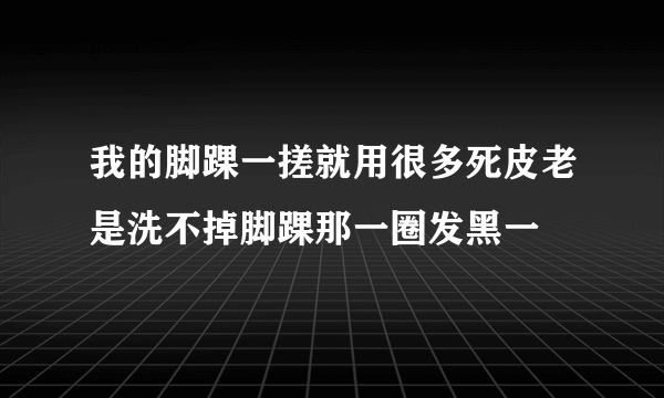 我的脚踝一搓就用很多死皮老是洗不掉脚踝那一圈发黑一