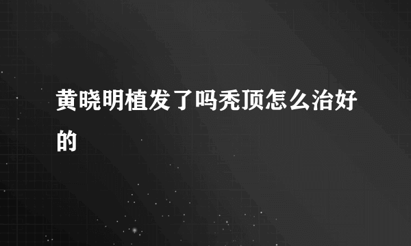 黄晓明植发了吗秃顶怎么治好的