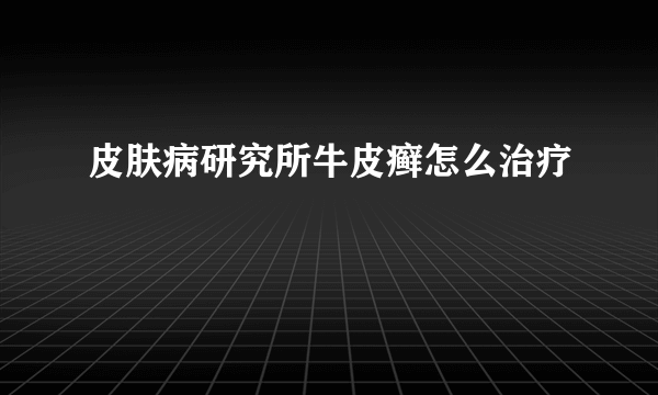 皮肤病研究所牛皮癣怎么治疗