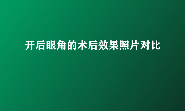 开后眼角的术后效果照片对比