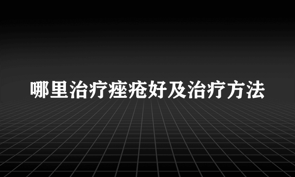 哪里治疗痤疮好及治疗方法