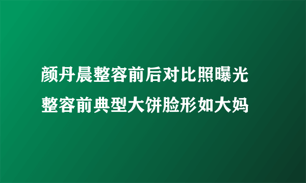 颜丹晨整容前后对比照曝光 整容前典型大饼脸形如大妈