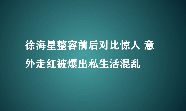 徐海星整容前后对比惊人 意外走红被爆出私生活混乱