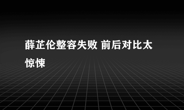 薛芷伦整容失败 前后对比太惊悚