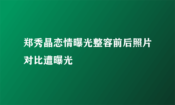 郑秀晶恋情曝光整容前后照片对比遭曝光