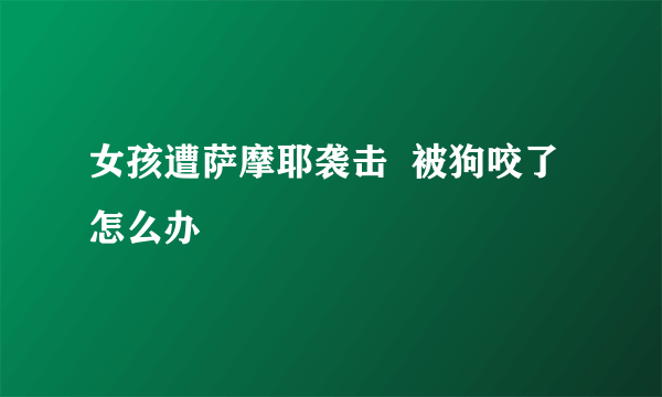 女孩遭萨摩耶袭击  被狗咬了怎么办