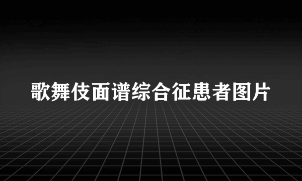 歌舞伎面谱综合征患者图片