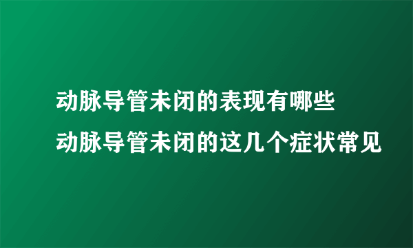 动脉导管未闭的表现有哪些 动脉导管未闭的这几个症状常见