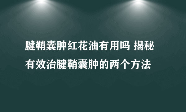 腱鞘囊肿红花油有用吗 揭秘有效治腱鞘囊肿的两个方法