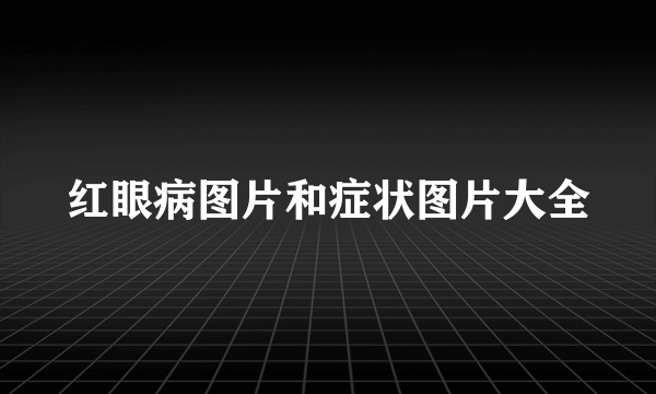 红眼病图片和症状图片大全