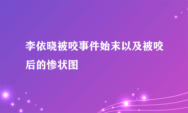 李依晓被咬事件始末以及被咬后的惨状图