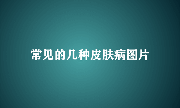 常见的几种皮肤病图片