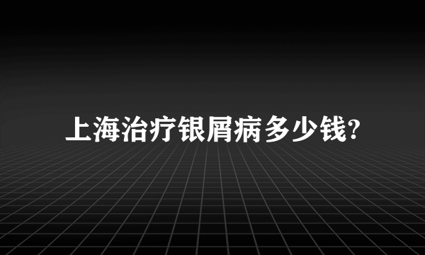 上海治疗银屑病多少钱?