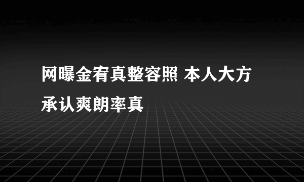 网曝金宥真整容照 本人大方承认爽朗率真