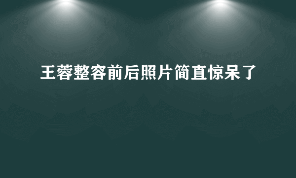 王蓉整容前后照片简直惊呆了