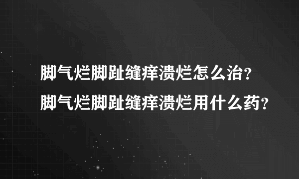 脚气烂脚趾缝痒溃烂怎么治？脚气烂脚趾缝痒溃烂用什么药？