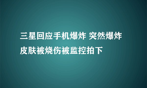 三星回应手机爆炸 突然爆炸皮肤被烧伤被监控拍下