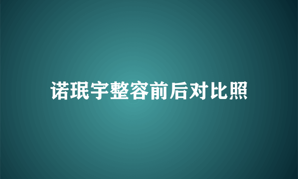 诺珉宇整容前后对比照