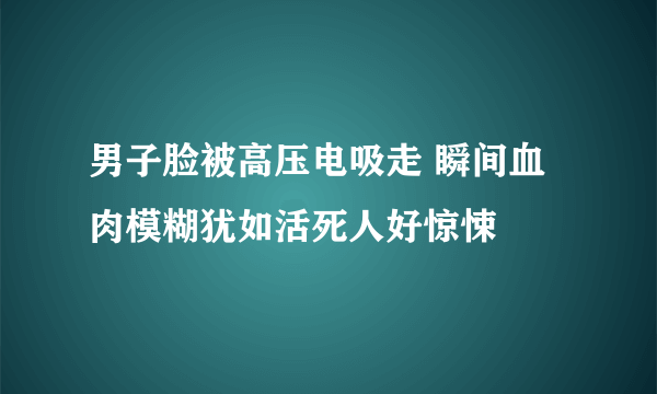 男子脸被高压电吸走 瞬间血肉模糊犹如活死人好惊悚