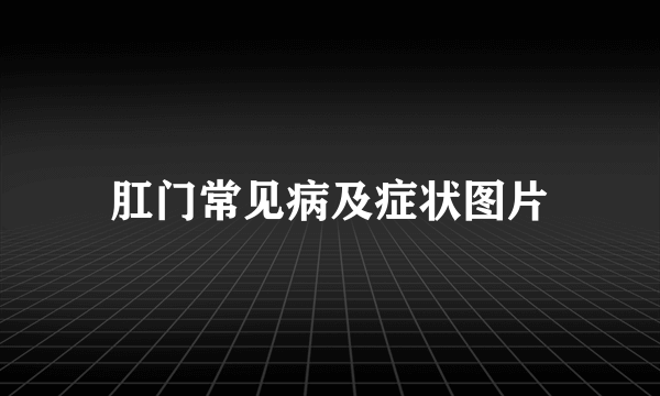 肛门常见病及症状图片