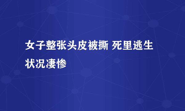 女子整张头皮被撕 死里逃生状况凄惨