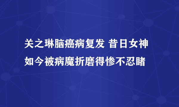 关之琳脑癌病复发 昔日女神如今被病魔折磨得惨不忍睹