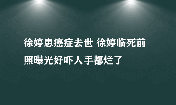 徐婷患癌症去世 徐婷临死前照曝光好吓人手都烂了