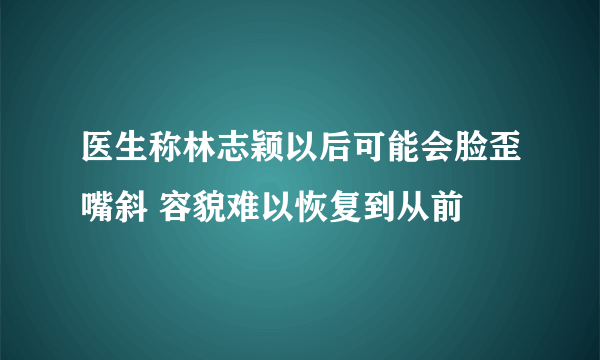 医生称林志颖以后可能会脸歪嘴斜 容貌难以恢复到从前