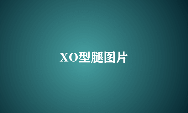 XO型腿图片