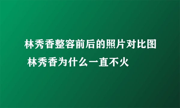 林秀香整容前后的照片对比图 林秀香为什么一直不火