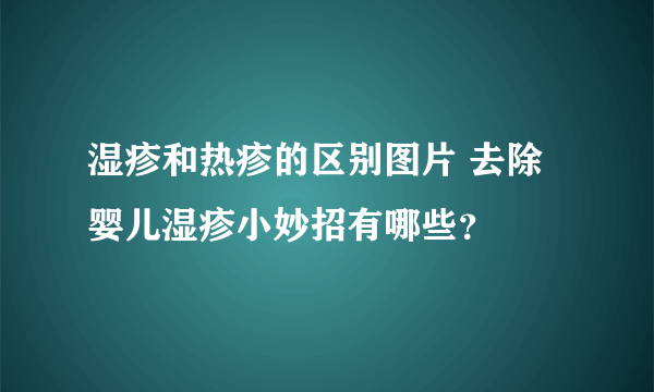 湿疹和热疹的区别图片 去除婴儿湿疹小妙招有哪些？