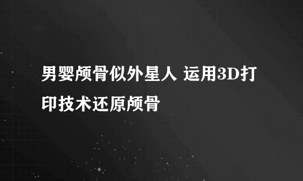 男婴颅骨似外星人 运用3D打印技术还原颅骨