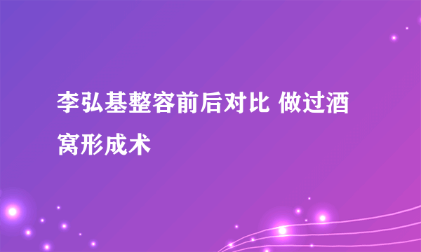 李弘基整容前后对比 做过酒窝形成术